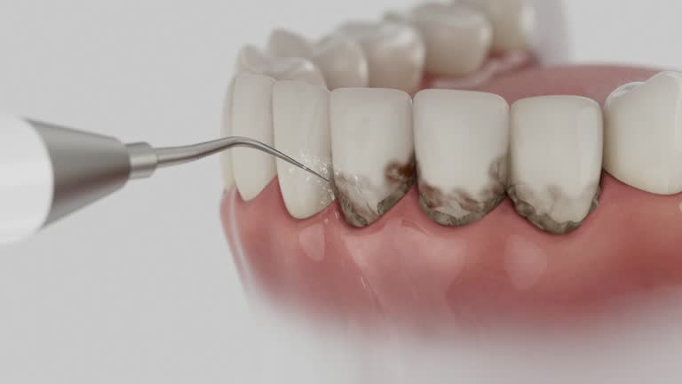 Reliable Dental contractor in St. Clair County County, MO by Dentist Open Now